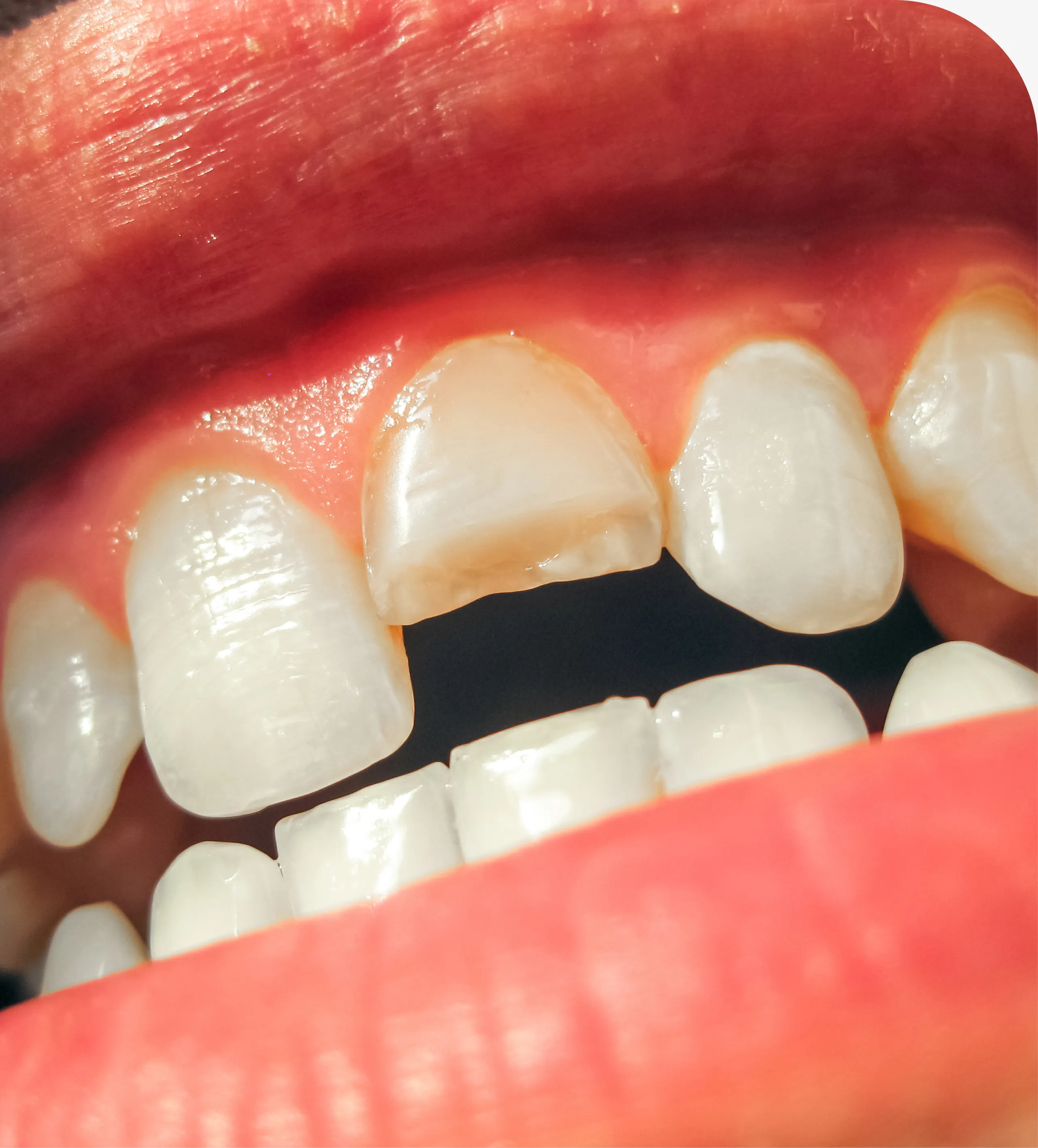 Restorative Dentistry