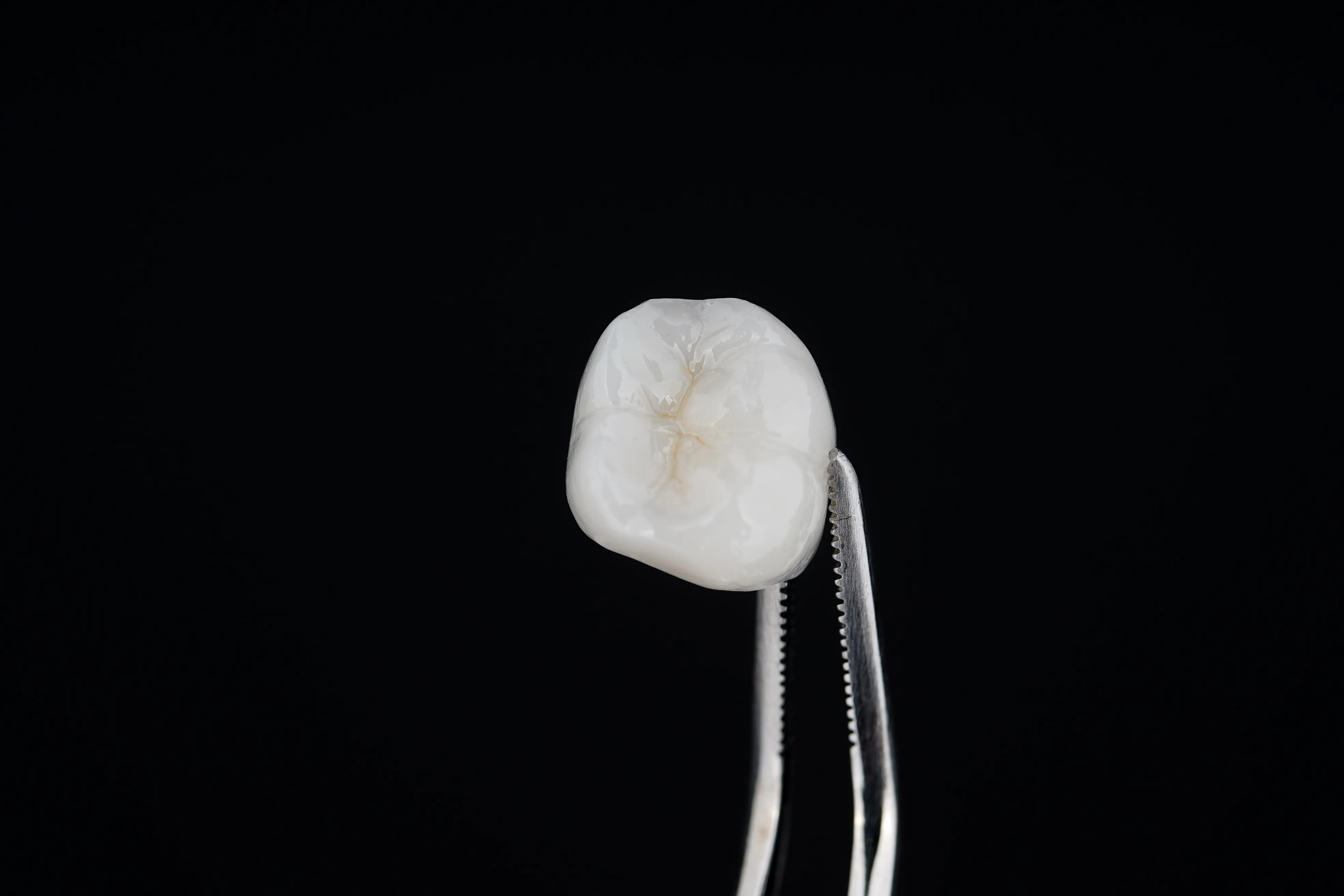 Same-Day Dental Crowns