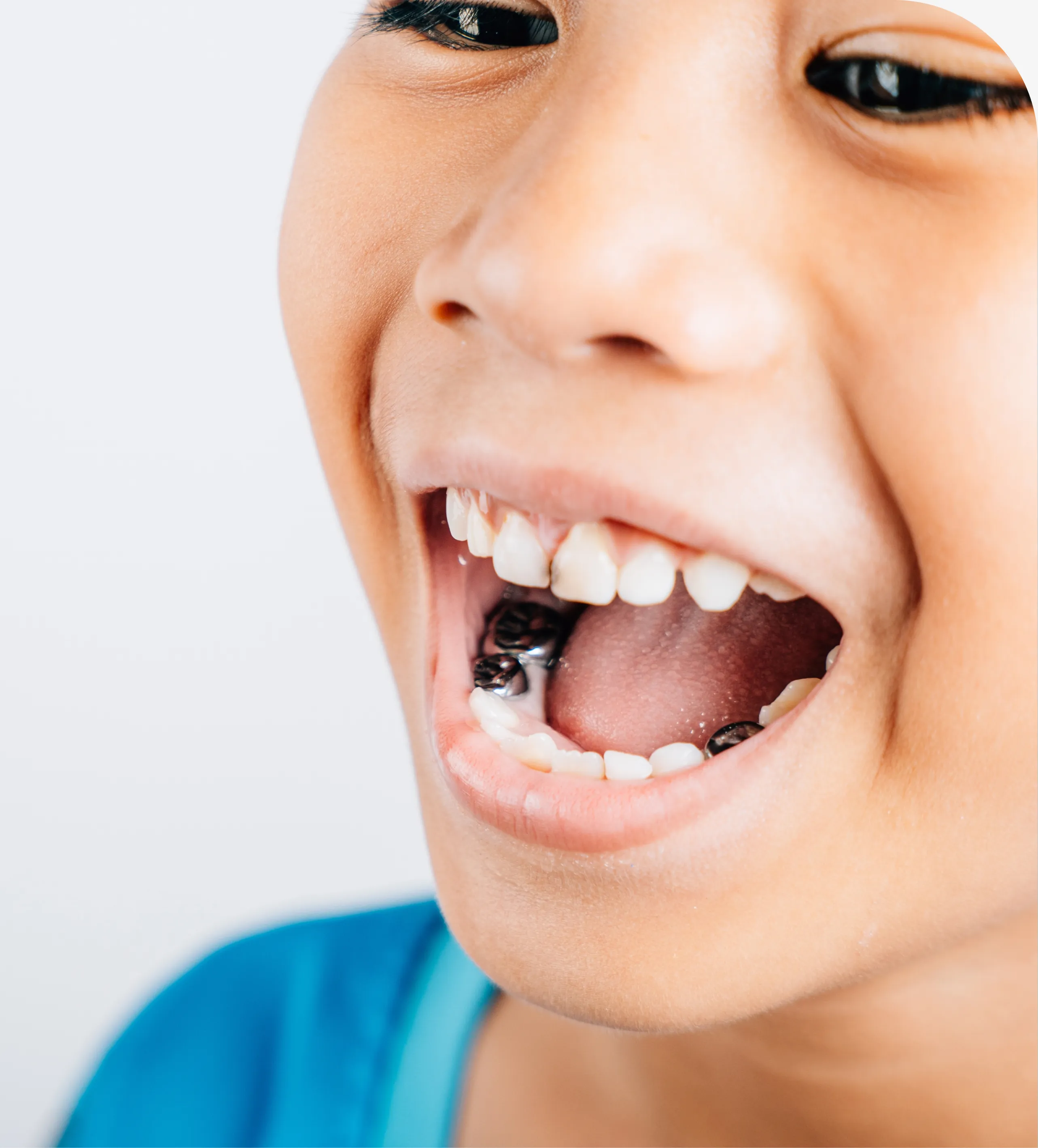 Children's Dentistry