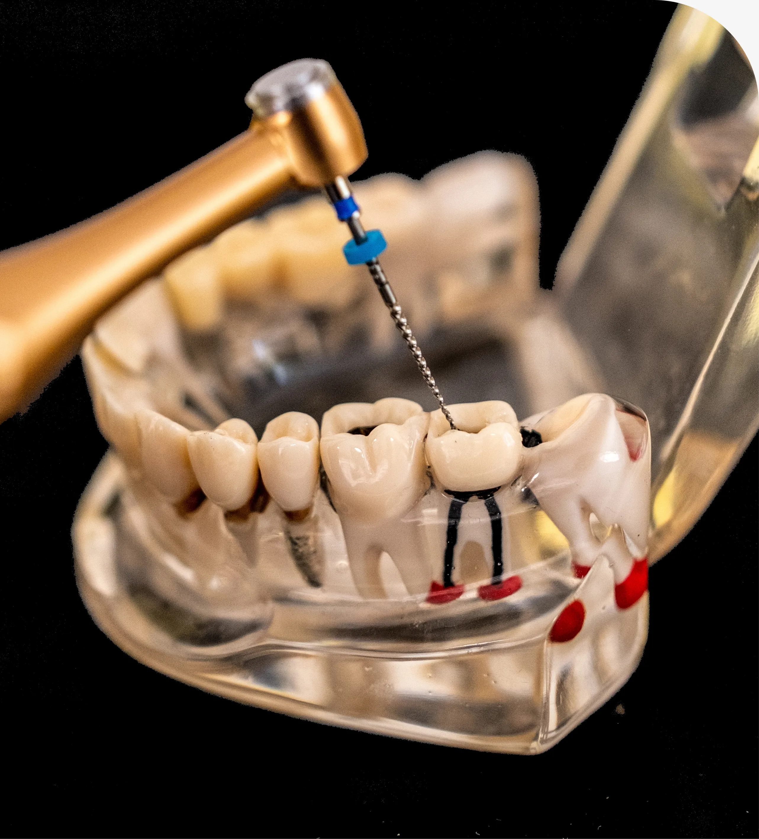 Oral Surgery