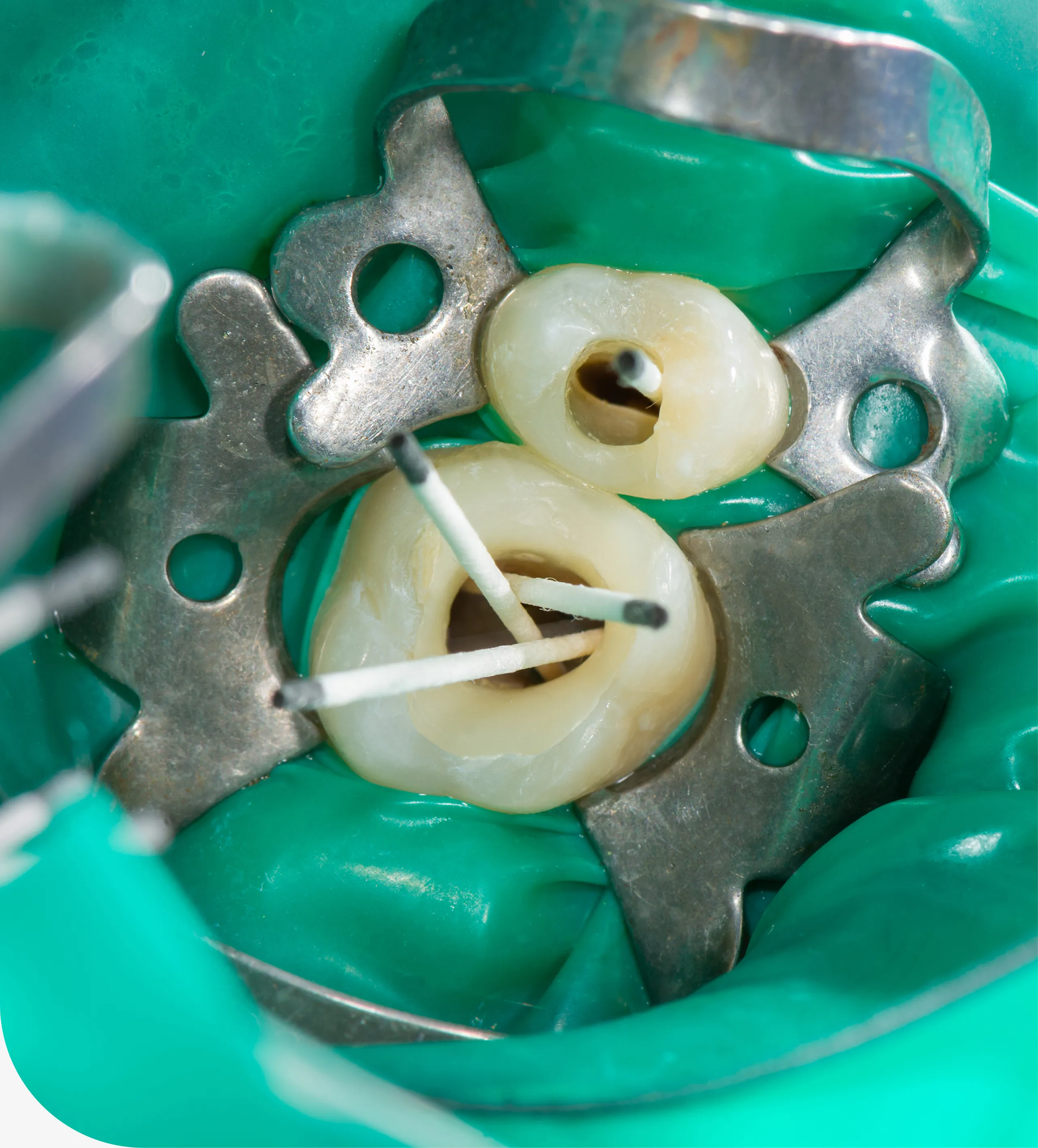 Periodontics