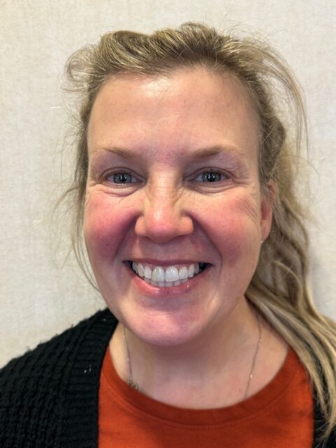After Image: Veneers - front