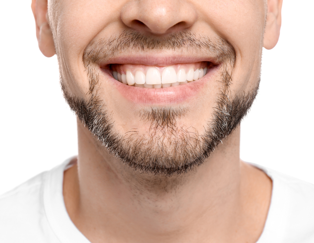 Man with harmonious smile after crown lengthening in Royal Oak. MI